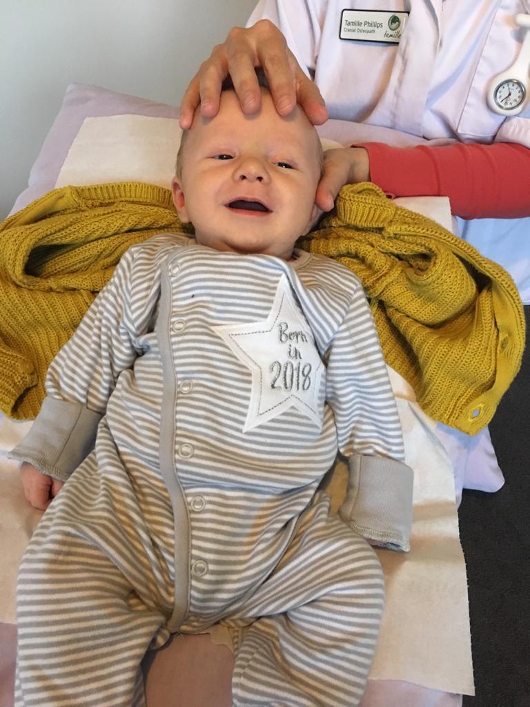 Image of sleeping baby receiving cranial treatment.